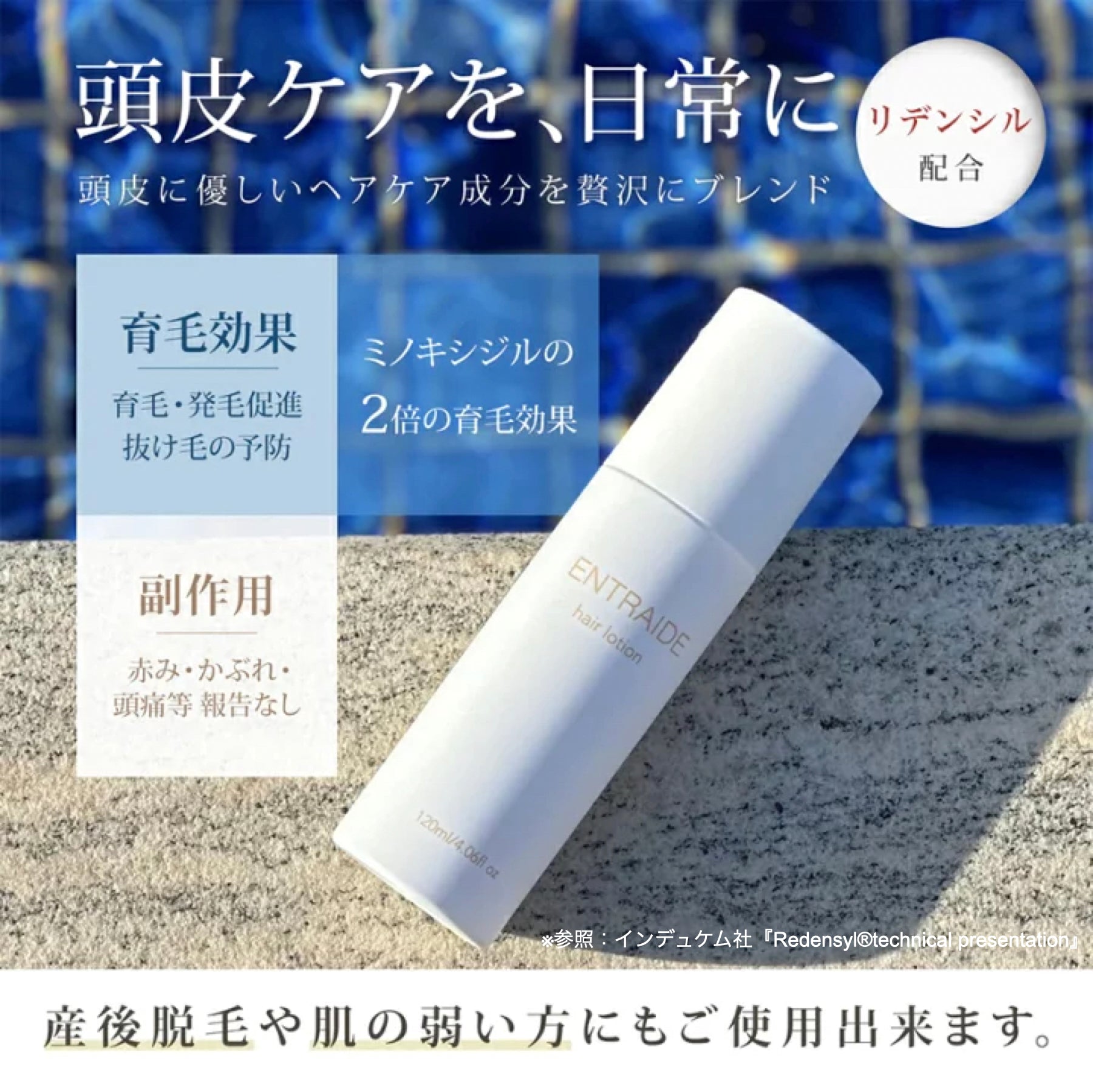 アントレッド ヘアローション (医薬部外品)育毛剤 120ml